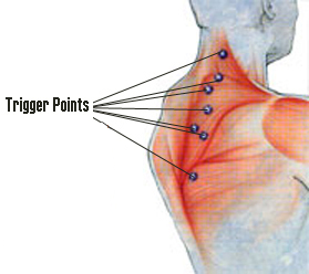 How Massage Can Help Alleviate Knots & Pain in the Neck & Shoulder Area